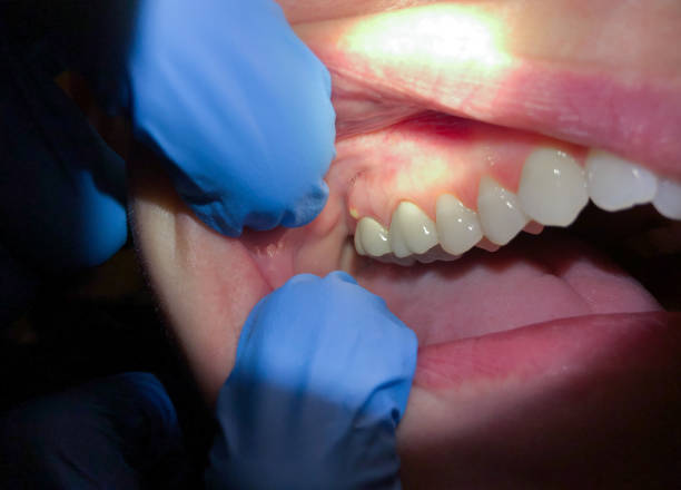 Best Weekend Emergency Dentist in Norcross, GA